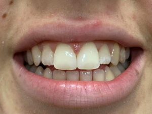 Clínica Dental Torres - Figueres